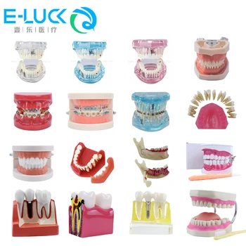 Zubné Zuby Model Viaceré Typy Výučby Typodont Ortodontická Model eaching Štúdia Lekárske Vedy Choroby Stomatológia Produkty